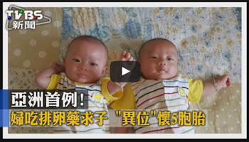 亞洲首例！ 婦吃排卵藥求子「異位」懷5胞胎