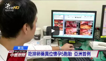 不孕症治療 吃排卵藥懷5胞胎 亞洲首例