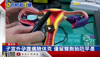 人工生殖1次五胞胎 創亞洲最多異位懷孕紀錄