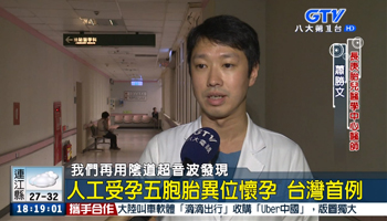 人工受孕五胞胎異位懷孕 台灣首例