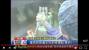 胎兒植幹細胞　玻璃娃娃「逆轉」不骨折