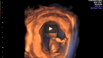 小寶貝在子宮內跳舞！