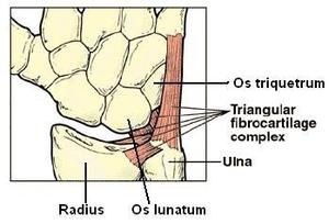 腕關節之淺談三角纖維軟骨複合體損傷