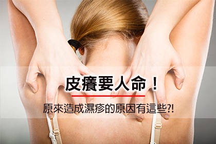 皮癢要人命!原來造成濕疹的原因有這些?! 皮癢要人命!原來造成濕疹的原因有這些?!
