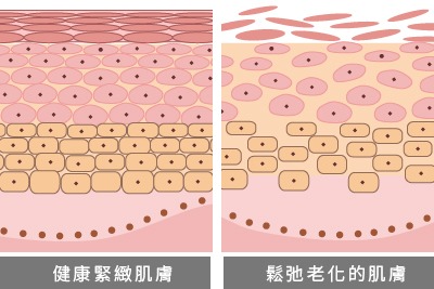 抗皺