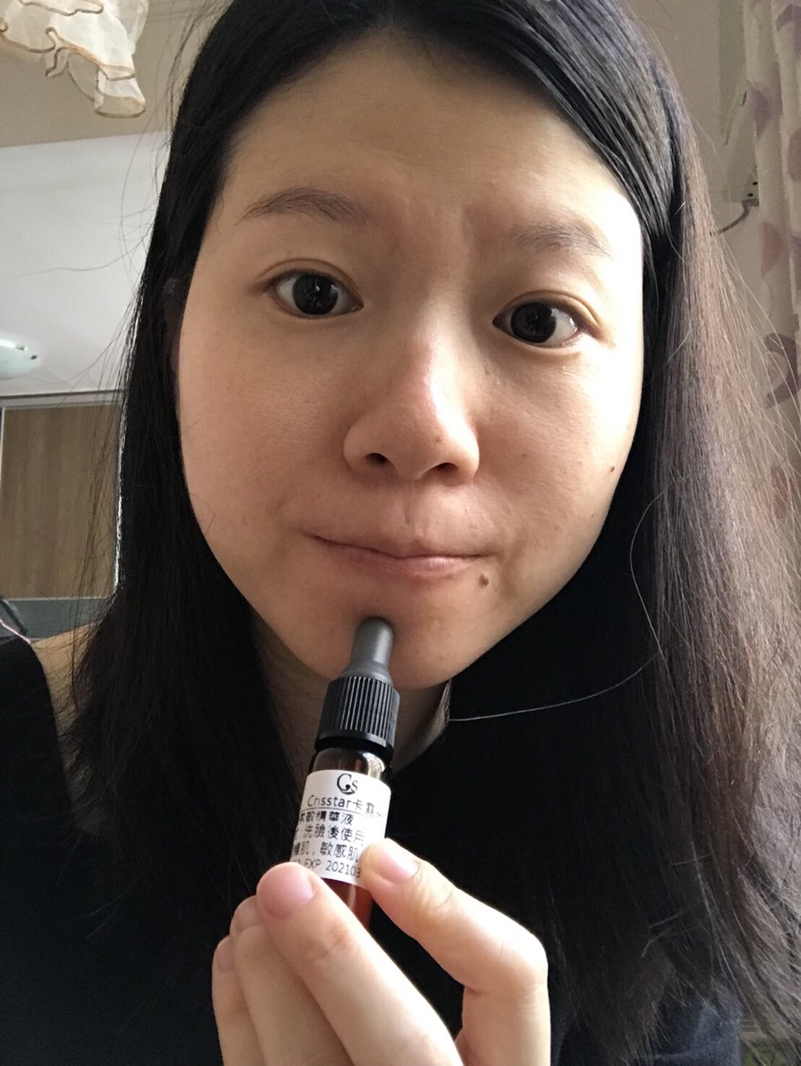 【酒糟肌有感推薦】真心覺得柔敏精華真的是我的救星~~~