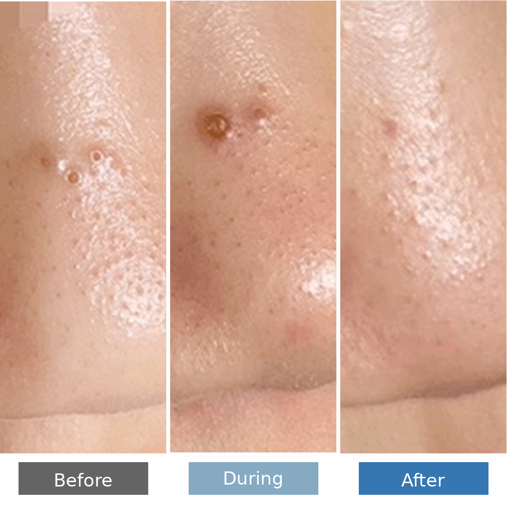 before_during_after_original_1040