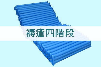 褥瘡發生的四個時期 褥瘡發生的四個時期