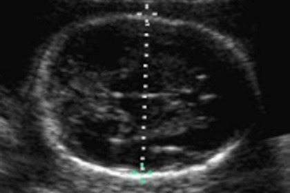 產檢超音波篩檢作業指南